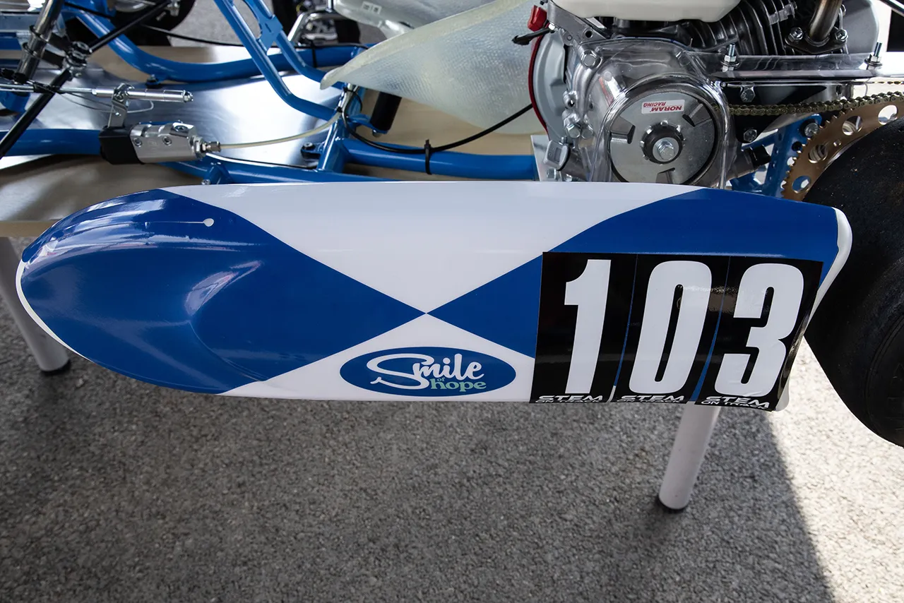 smile of hope kart build project
